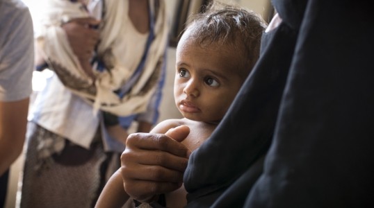 A child at one of Action Against Hunger’s health clinics in Yemen, a country on the brink of famine